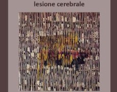 Convegno: Cerebrolesioni Acquisite in Età Evolutiva – Milano Ottobre 2016